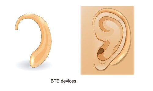 BTE hearing aids