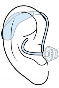 open fit hearing aid