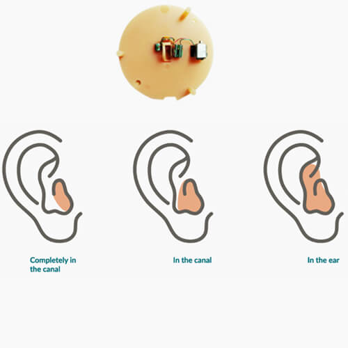 hearing aid faceplate