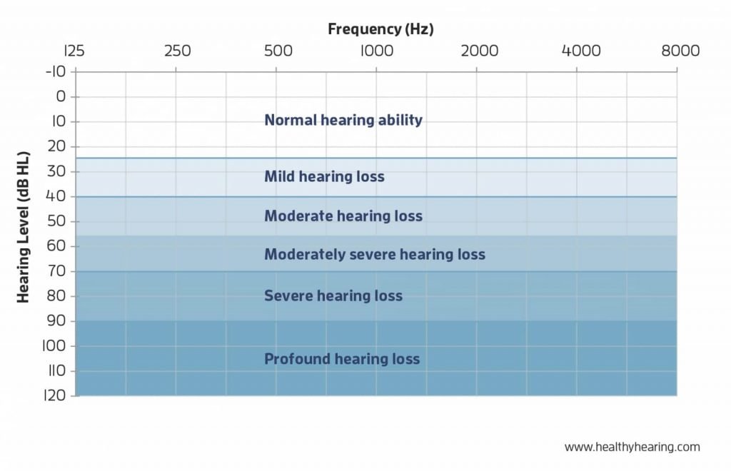 hearing-loss-level-graph