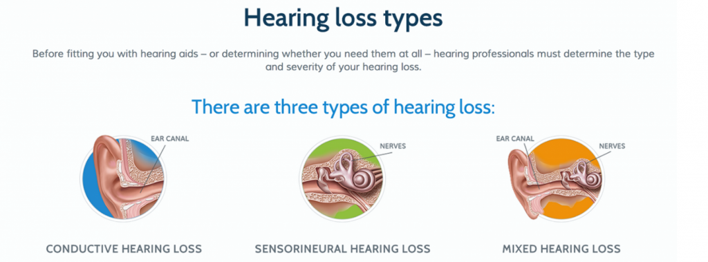 hearing loss types